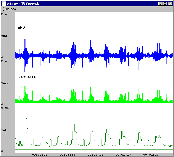 software module, ecg software, blood pressure analysis, EMG