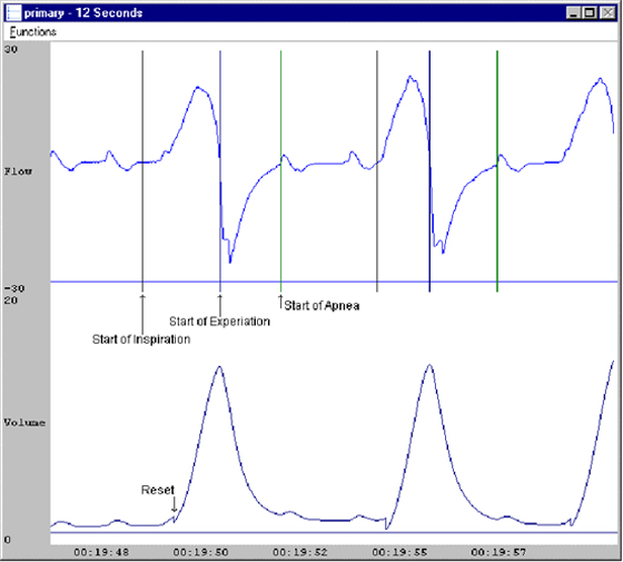 software module, ecg software, blood pressure analysis