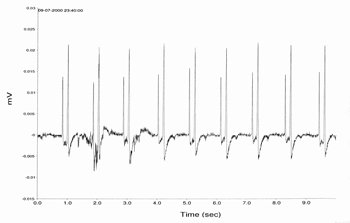 fishecggraph