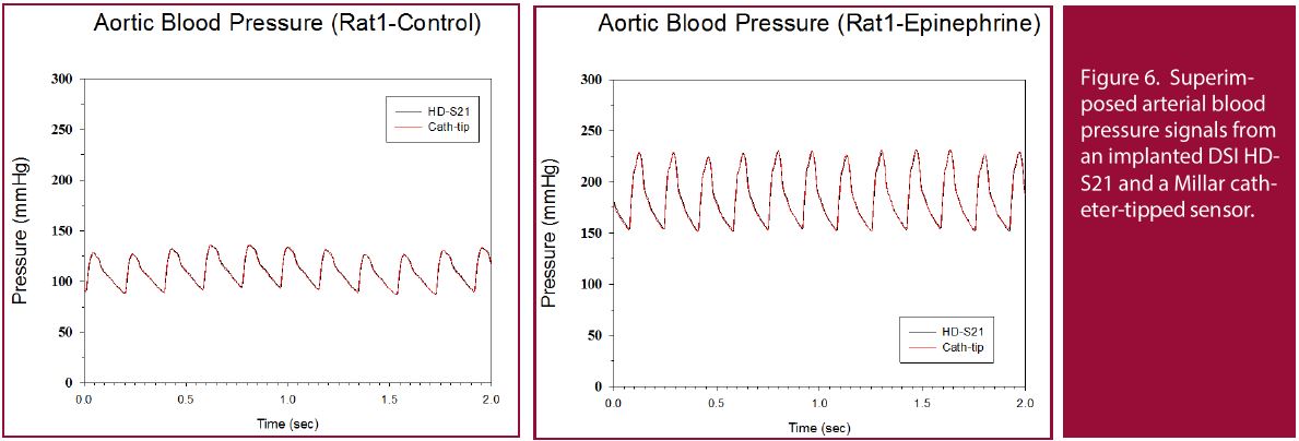 Blood Pressure