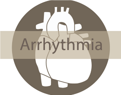 Arrythmia