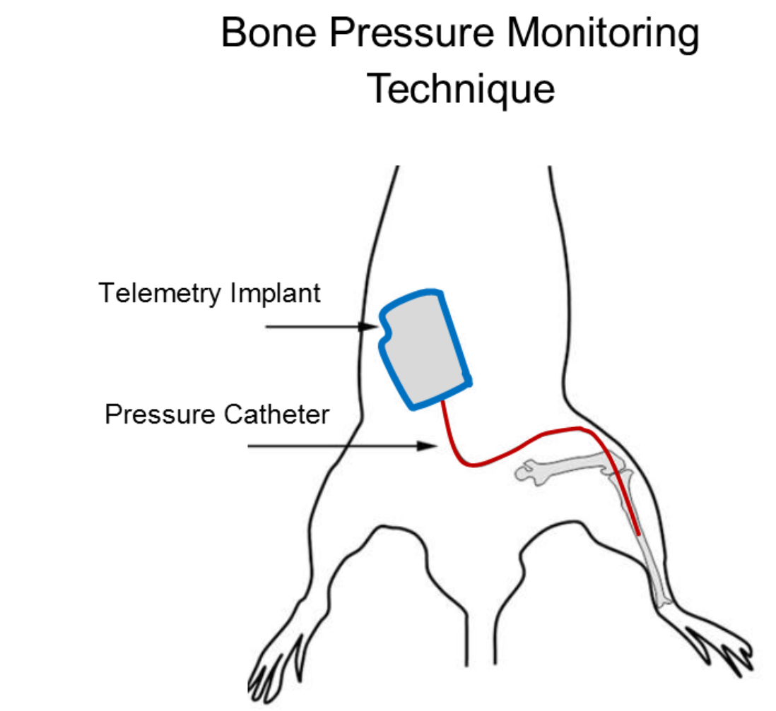 Bone Pressure