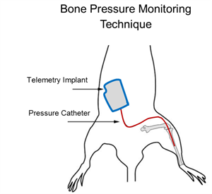 Bone Pressure