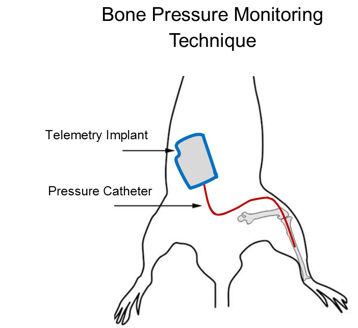 Bone pressure