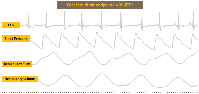 JET_SignalTypes