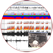 neuroscore, cns software, seizure detection, sleep scoring