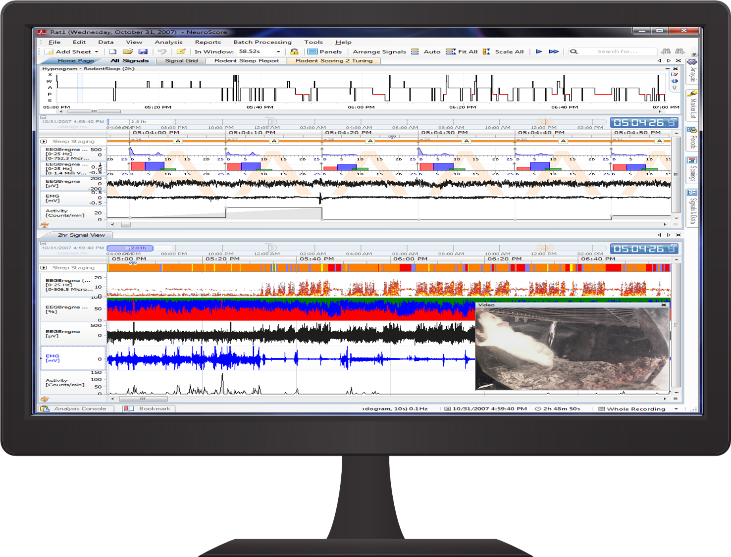 NeuroScore