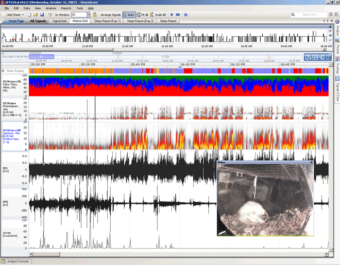 Neuroscore, video monitoring, cns software