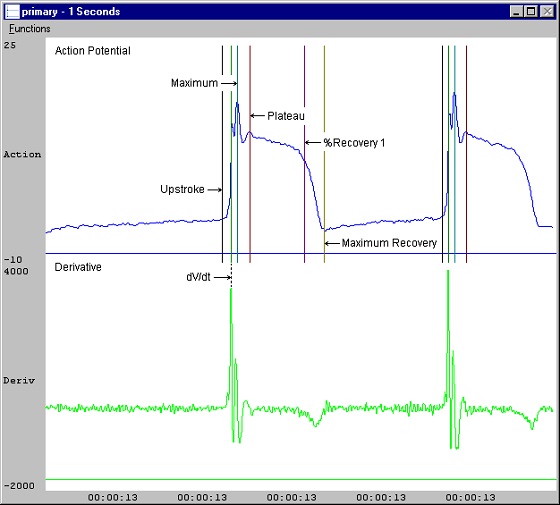 software module, ecg software, blood pressure analysis, ep catheter