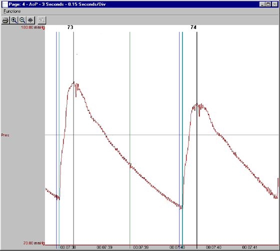 Blood clearance pressure software