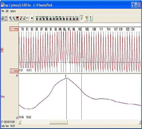 blood pressure respiration software