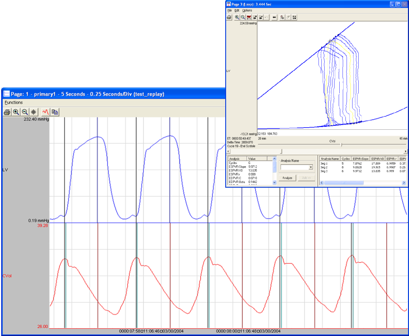 ecg software, software module, blood pressure analysis