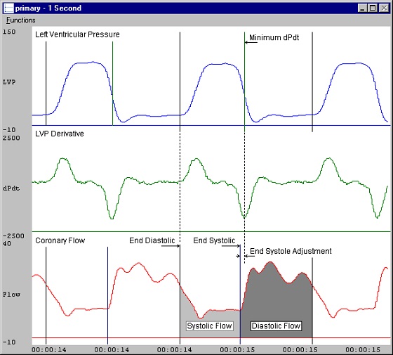 ecg software, software module, blood pressure analysis