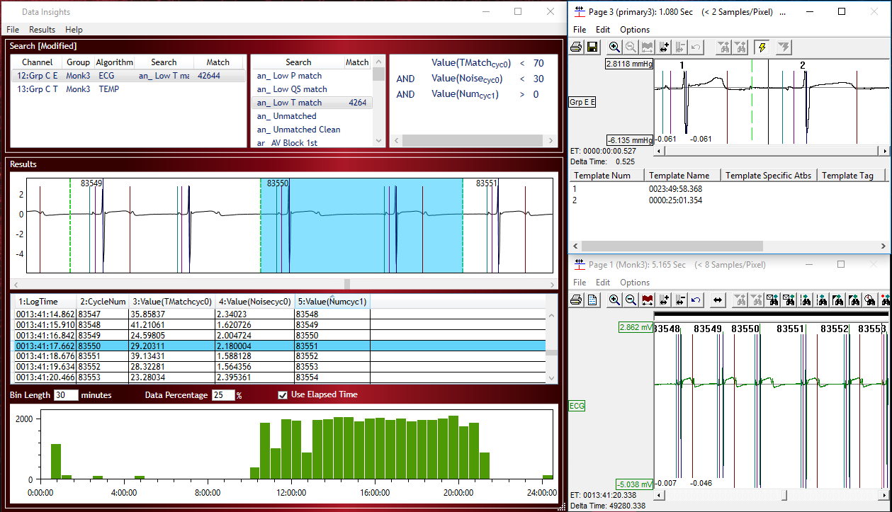 ecg software ecg software