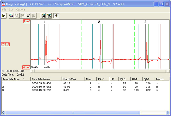 ecg analysis, ecg data analysis, ecg analysis software