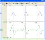 software module, ecg software, blood pressure analysis