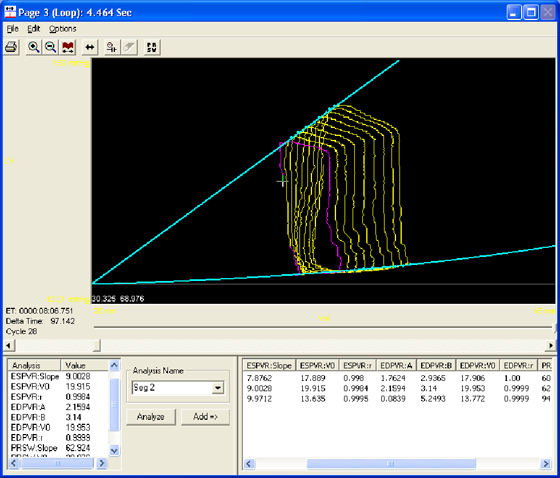 pressure volume loop, PV loop, cardiac pressure volume loop, ecg software, software module, blood pressure analysis