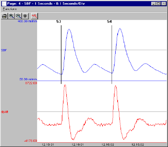 ecg software, software module, blood pressure analysis