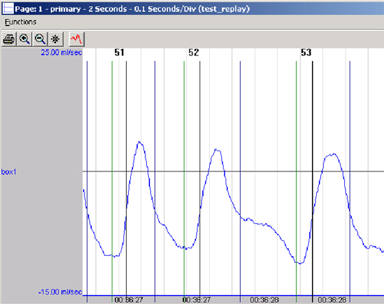 software module, ecg software, blood pressure analysis, respiration, respiratory rate, plethysmography