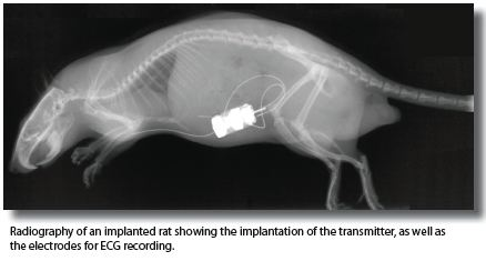 Radiotelemetric and Symptomatic Evaluation